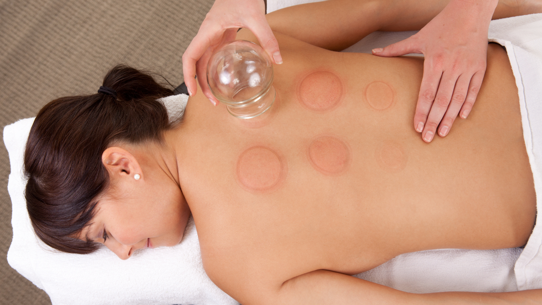 Does cupping help you sleep?